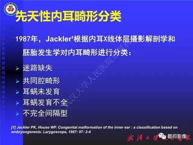 【PPT】先天性内耳畸形影像诊断