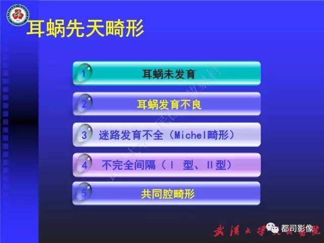 【PPT】先天性内耳畸形影像诊断