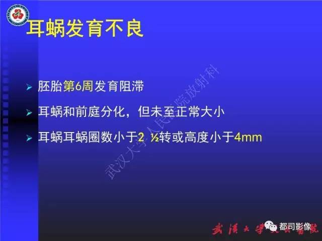【PPT】先天性内耳畸形影像诊断