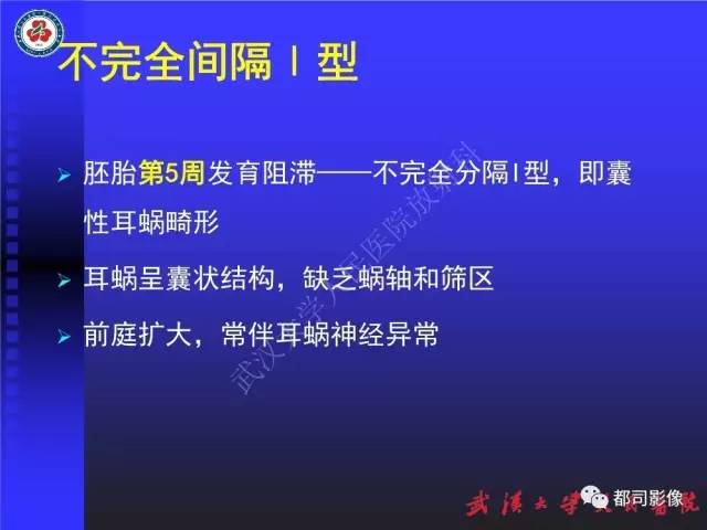 【PPT】先天性内耳畸形影像诊断