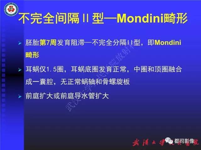 【PPT】先天性内耳畸形影像诊断