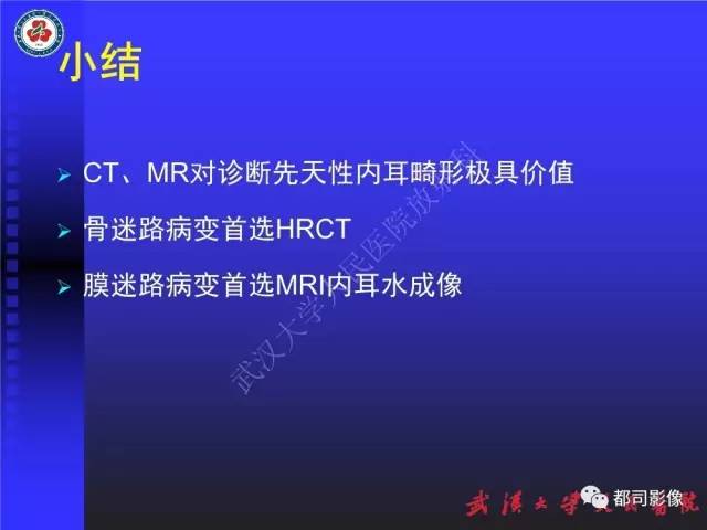 【PPT】先天性内耳畸形影像诊断