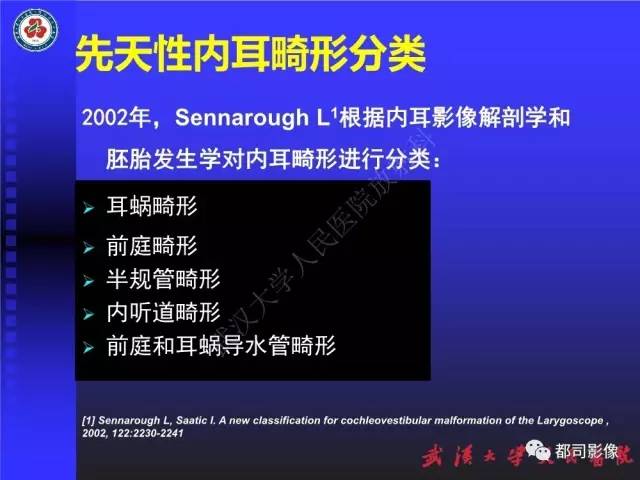 【PPT】先天性内耳畸形影像诊断