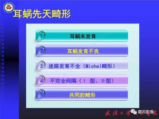 【PPT】先天性内耳畸形影像诊断