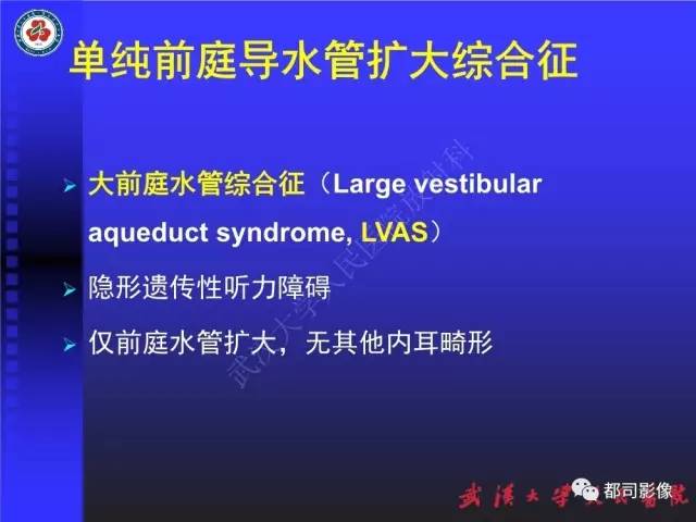 【PPT】先天性内耳畸形影像诊断