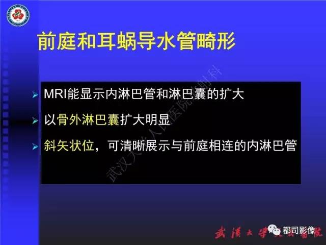 【PPT】先天性内耳畸形影像诊断