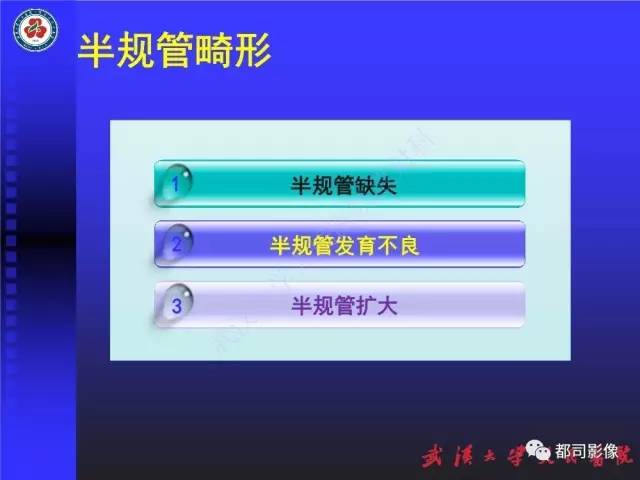 【PPT】先天性内耳畸形影像诊断
