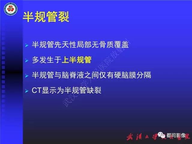 【PPT】先天性内耳畸形影像诊断