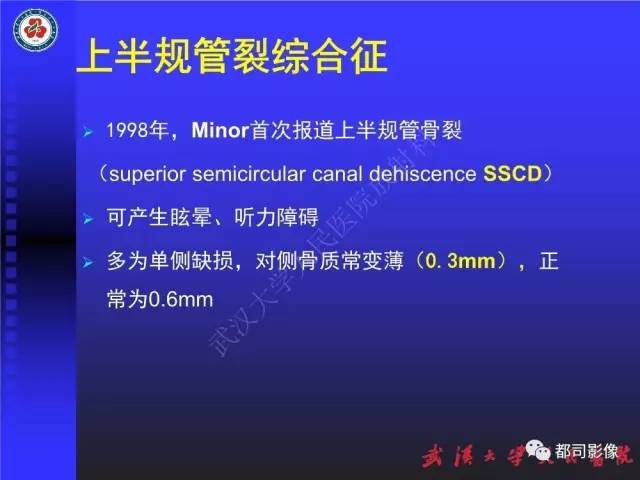 【PPT】先天性内耳畸形影像诊断
