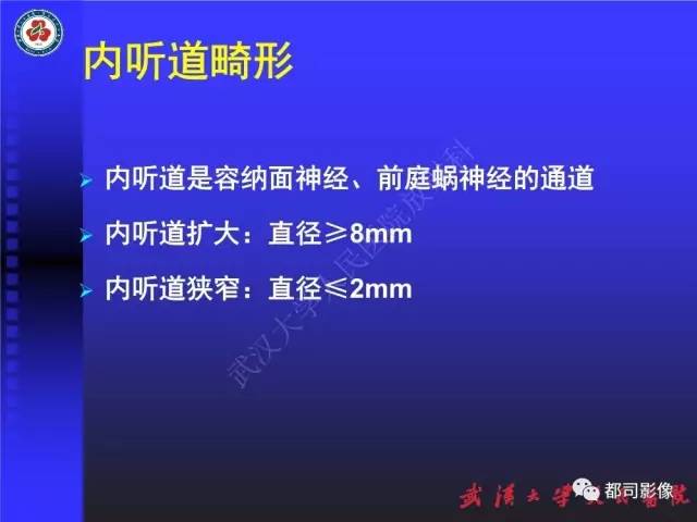 【PPT】先天性内耳畸形影像诊断