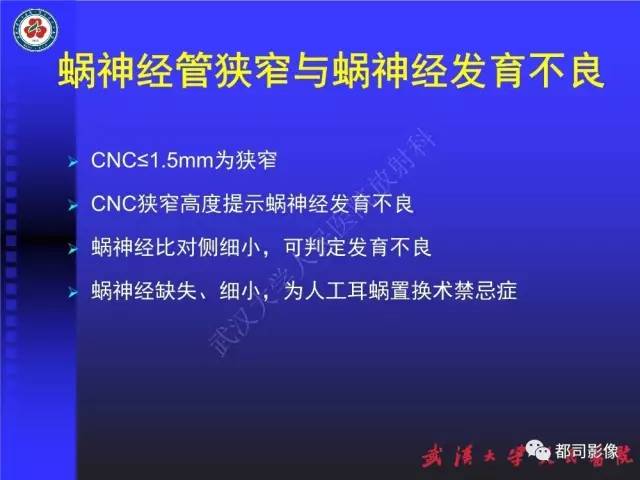 【PPT】先天性内耳畸形影像诊断