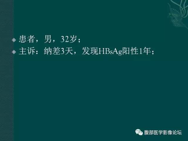 【病例】肝脏炎性肌纤维母细胞瘤1例CT及MR
