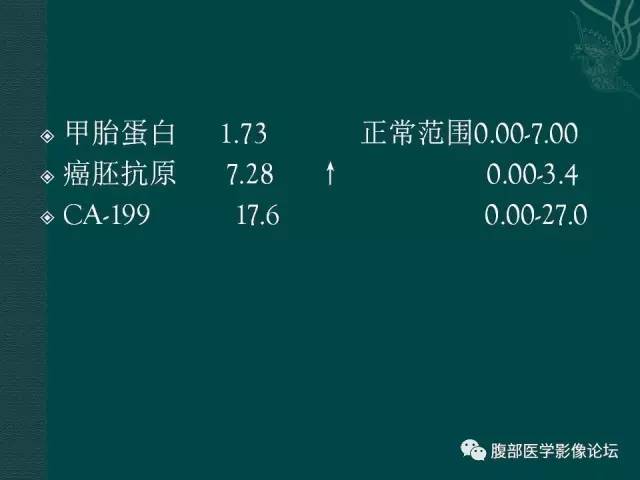 【病例】肝脏炎性肌纤维母细胞瘤1例CT及MR