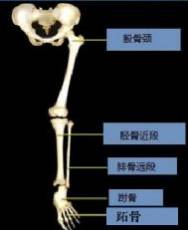 疲劳骨折 疲劳骨折