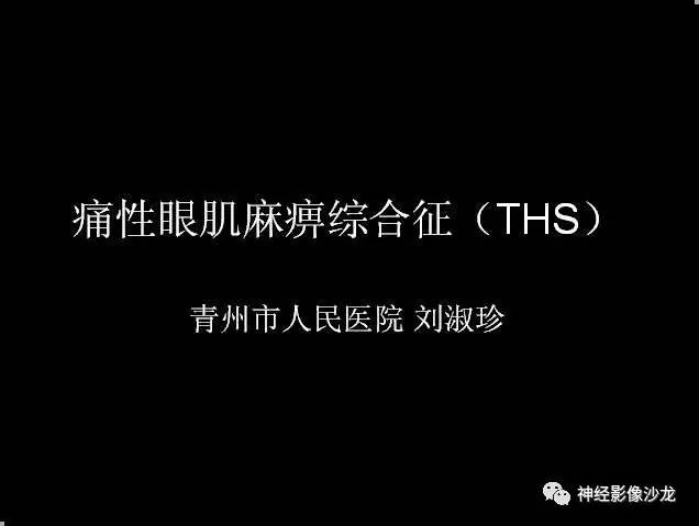 【病例】痛性眼肌麻痹综合征THS一例CT及MR影像表现