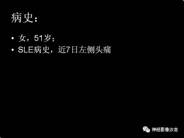 【病例】痛性眼肌麻痹综合征THS一例CT及MR影像表现