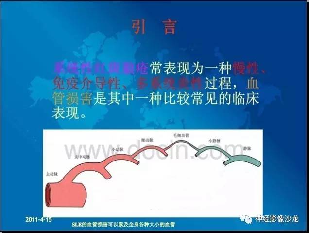 【病例】痛性眼肌麻痹综合征THS一例CT及MR影像表现