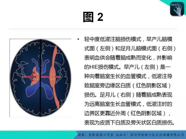 【PPT】新生儿缺氧缺血性脑病多模态影像学表现