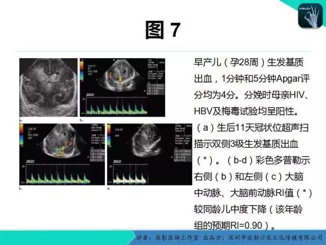 【PPT】新生儿缺氧缺血性脑病多模态影像学表现