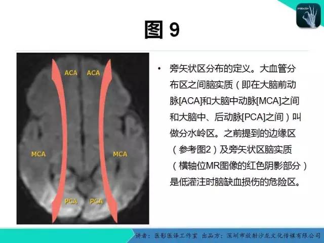 【PPT】新生儿缺氧缺血性脑病多模态影像学表现