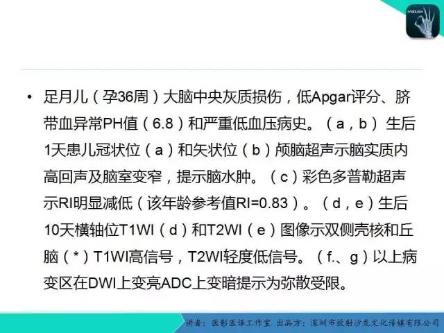 【PPT】新生儿缺氧缺血性脑病多模态影像学表现