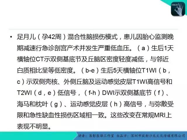 【PPT】新生儿缺氧缺血性脑病多模态影像学表现