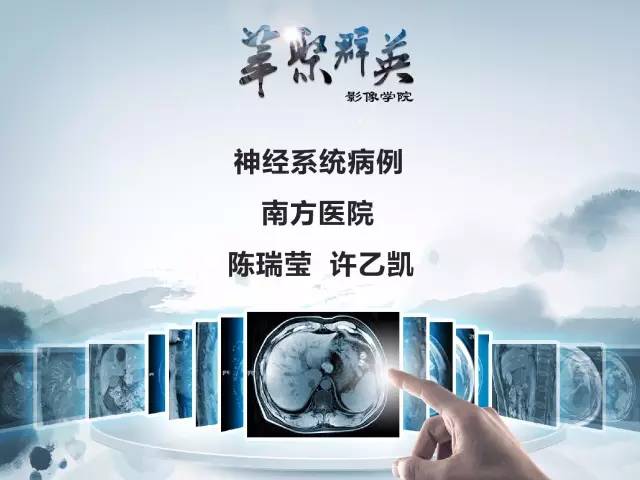 【病例】Clippers综合征1例MR影像表现