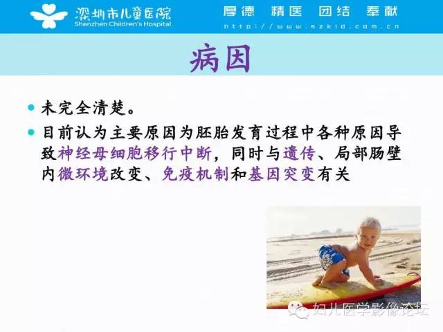 【PPT】先天性巨结肠的影像诊断