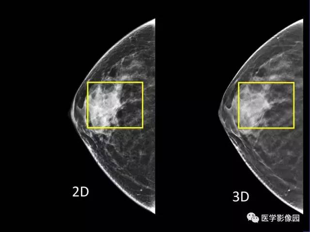 【PPT】乳腺肿瘤影像检查方法与诊断思路