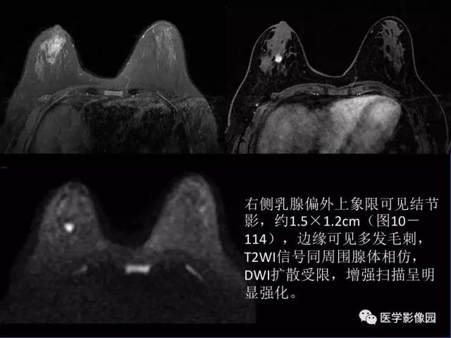 【PPT】乳腺肿瘤影像检查方法与诊断思路