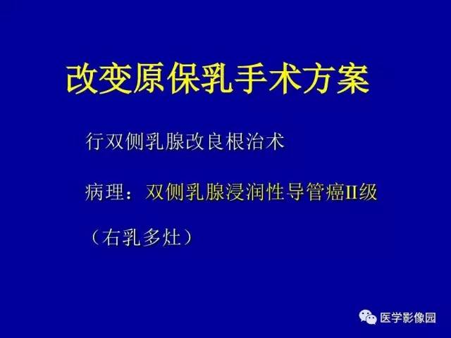 【PPT】乳腺肿瘤影像检查方法与诊断思路
