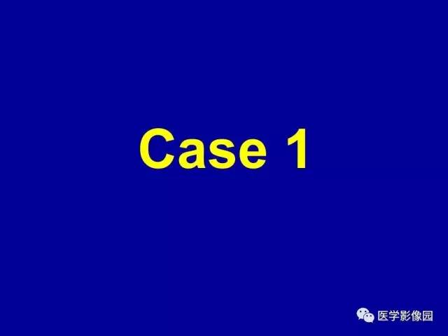 【PPT】乳腺肿瘤影像检查方法与诊断思路