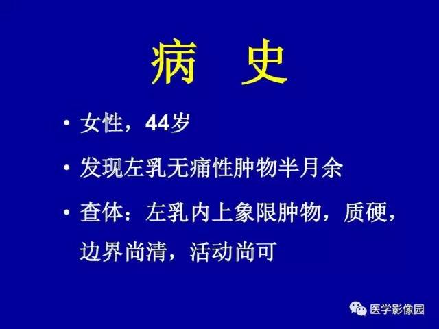 【PPT】乳腺肿瘤影像检查方法与诊断思路