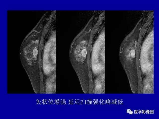【PPT】乳腺肿瘤影像检查方法与诊断思路