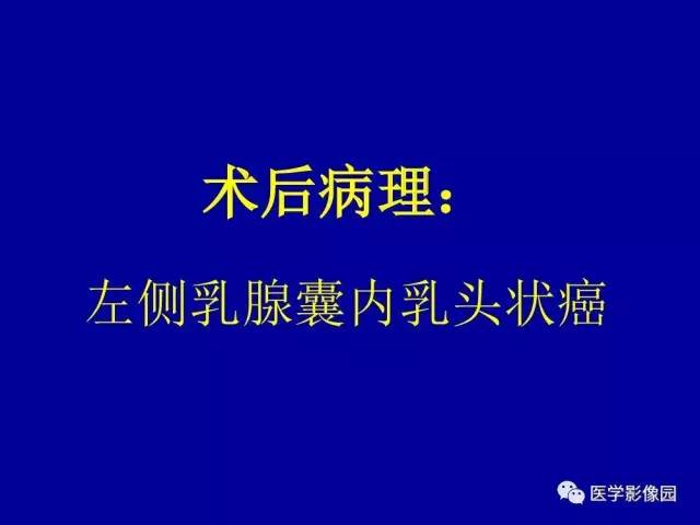 【PPT】乳腺肿瘤影像检查方法与诊断思路