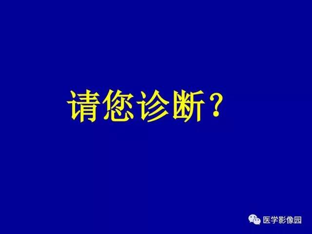 【PPT】乳腺肿瘤影像检查方法与诊断思路