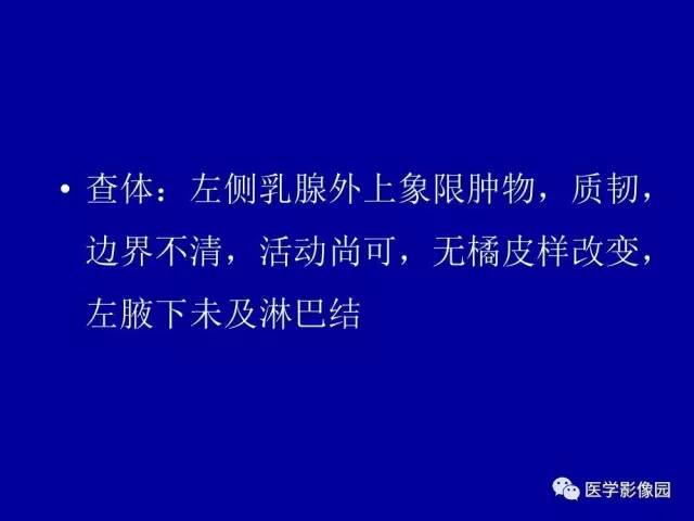 【PPT】乳腺肿瘤影像检查方法与诊断思路