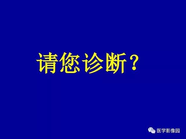 【PPT】乳腺肿瘤影像检查方法与诊断思路
