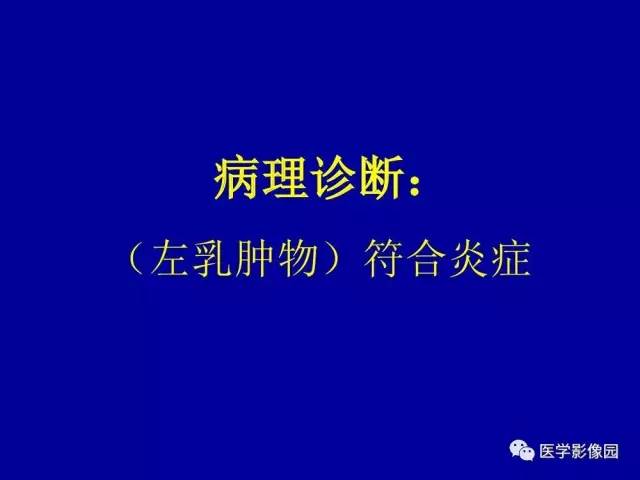 【PPT】乳腺肿瘤影像检查方法与诊断思路