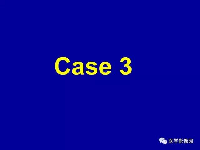 【PPT】乳腺肿瘤影像检查方法与诊断思路