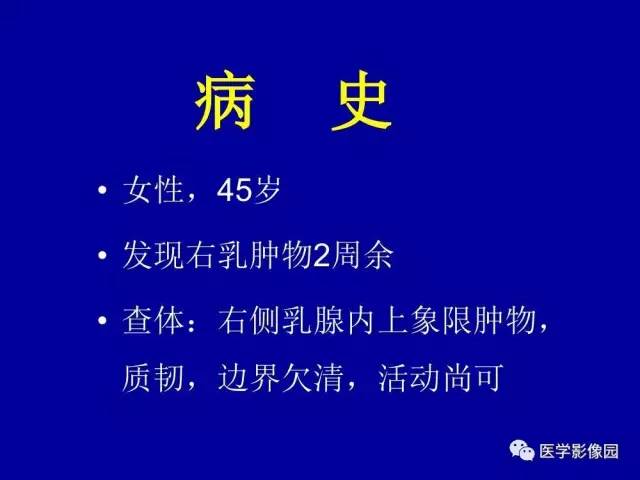 【PPT】乳腺肿瘤影像检查方法与诊断思路