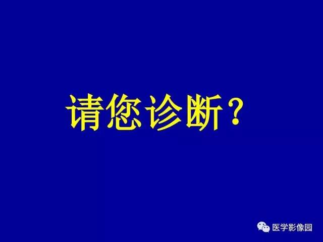 【PPT】乳腺肿瘤影像检查方法与诊断思路
