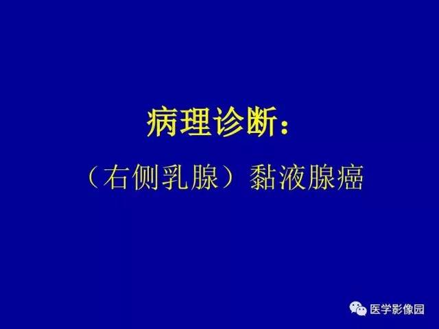 【PPT】乳腺肿瘤影像检查方法与诊断思路
