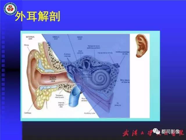 【PPT】先天性外耳和中耳畸形CT诊断