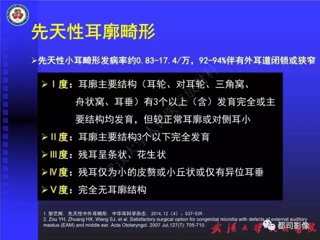 【PPT】先天性外耳和中耳畸形CT诊断