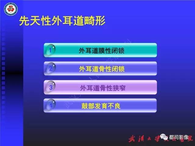 【PPT】先天性外耳和中耳畸形CT诊断