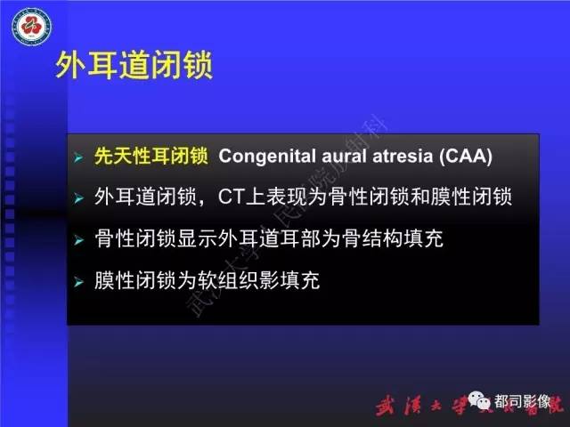 【PPT】先天性外耳和中耳畸形CT诊断