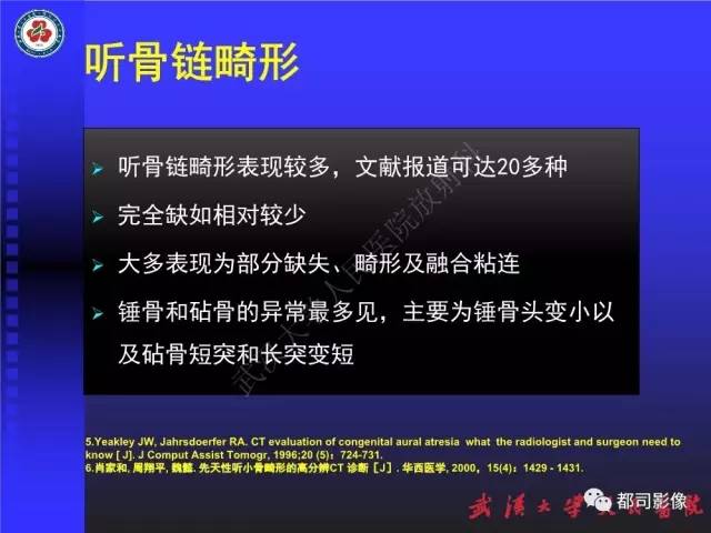 【PPT】先天性外耳和中耳畸形CT诊断
