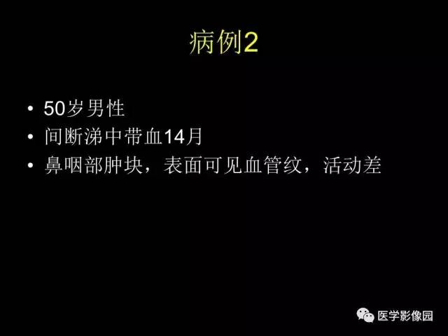 【PPT】头颈部恶性肿瘤影像诊断 重视颅底神经孔道改变