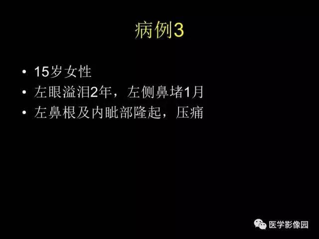 【PPT】头颈部恶性肿瘤影像诊断 重视颅底神经孔道改变